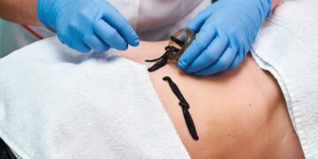 Достоинства живых пиявок и советы по использованию в медицинских целях