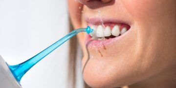 Правила догляду за яснами після лікування пародонтиту