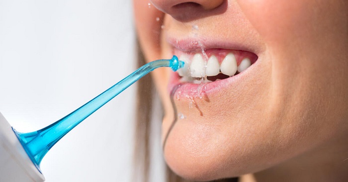 Правила догляду за яснами після лікування пародонтиту